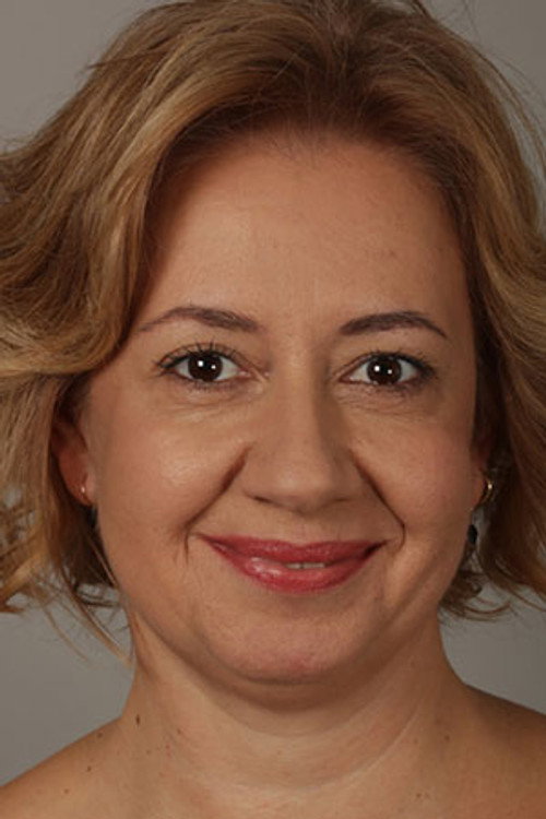 Özlem Çakar profil fotoğrafı